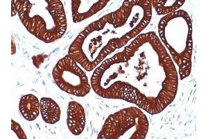 Formalin-fixed, paraffin-embedded human Colon stained with Cytokeratin 19 Mouse Monoclonal Antibody (BA17) (Cytokeratin 19 Antikörper)