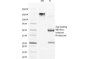 SDS-PAGE Analysis Purified CDX1 Mouse Monoclonal Antibody (CDX1/1650). (CDX1 Antikörper)