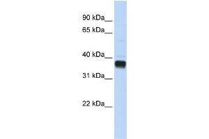 Western Blotting (WB) image for anti-Nudix (Nucleoside Diphosphate Linked Moiety X)-Type Motif 18 (NUDT18) (C-Term) antibody (ABIN2783563)
