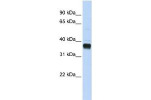 WB Suggested Anti-NUDT18 Antibody Titration:  0.