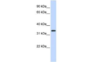 WB Suggested Anti-FLJ23356 Antibody Titration:  0. (SGK196 Antikörper  (N-Term))