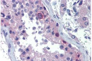 Human Testis (formalin-fixed, paraffin-embedded) stained with RHOXF2 antibody ABIN462204 followed by biotinylated goat anti-rabbit IgG secondary antibody ABIN481713, alkaline phosphatase-streptavidin and chromogen. (RHOXF2 Antikörper  (AA 108-157))
