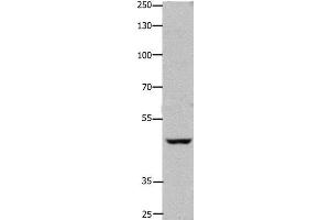 Western Blot analysis of Hela cell using FOXD3 Polyclonal Antibody at dilution of 1:450 (FOXD3 Antikörper)