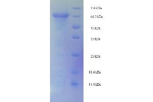 Glycoprotein 2 (Zymogen Granule Membrane) (GP2) (AA 22-531) protein (His-SUMO Tag)