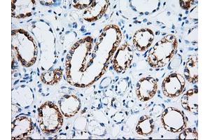 Immunohistochemical staining of paraffin-embedded Human Kidney tissue using anti-IGF2BP2 mouse monoclonal antibody. (IGF2BP2 Antikörper)
