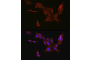 Immunofluorescence analysis of PC-12 cells using EIF4ENIF1 Rabbit pAb (ABIN7267051) at dilution of 1:100 (40x lens). (EIF4ENIF1 Antikörper  (AA 150-250))