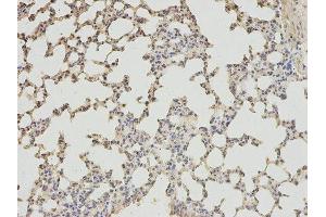 Immunohistochemistry (IHC) image for anti-4-Aminobutyrate Aminotransferase (ABAT) antibody (ABIN1876487) (ABAT Antikörper)
