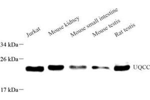 Western blot analysis of UQCC (ABIN7076094) at dilution of 1: 500 (Ubiquinol-Cytochrome C Reductase Complex Chaperone (UQCC) Antikörper)