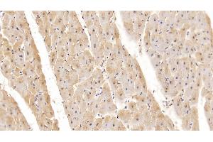Detection of MYO in Human Cardiac Muscle Tissue using Monoclonal Antibody to Myoglobin (MYO) (Myoglobin Antikörper  (AA 1-154))