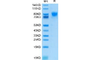 Human DNAM-1/CD226 on Tris-Bis PAGE under reduced condition. (CD226 Protein (CD226) (AA 19-247) (Fc Tag))