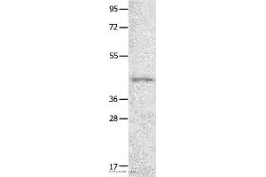 Western blot analysis of 231 cell  , using NTSR1 Polyclonal Antibody at dilution of 1:800 (NTSR1 Antikörper)