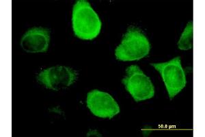 Immunofluorescence of monoclonal antibody to KRT18 on HeLa cell. (Cytokeratin 18 Antikörper  (AA 1-430))