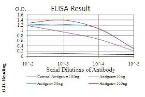 Black line: Control Antigen (100 ng), Purple line: Antigen(10 ng), Blue line: Antigen (50 ng), Red line: Antigen (100 ng), (Ezrin Antikörper  (AA 292-464))