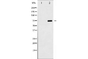 Western blot analysis of NF- kappaB p65 phosphorylation expression in TNF-α treated MDA-MB-231 whole cell lysates,The lane on the left is treated with the antigen-specific peptide.