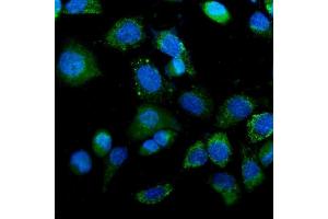 IF analysis of IDH2 using anti-IDH2 antibody (ABIN7602787).