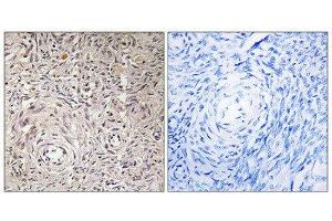 Immunohistochemistry (IHC) image for anti-Glucosaminyl (N-Acetyl) Transferase Family Member 7 (GCNT7) (C-Term) antibody (ABIN1850894) (GCNT7 Antikörper  (C-Term))