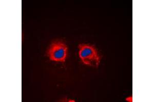 Immunofluorescent analysis of Cortactin (pY466) staining in HeLa cells. (Cortactin Antikörper  (C-Term, pTyr466))