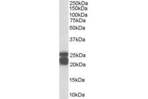 Western Blotting (WB) image for anti-Adenosine Deaminase-Like Protein (ADAL) (C-Term) antibody (ABIN2784644)