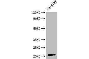 Western Blot Positive WB detected in: SH-SY5Y whole cell lysate All lanes: GNPNAT1 antibody at 1:2000 Secondary Goat polyclonal to rabbit IgG at 1/50000 dilution Predicted band size: 21 kDa Observed band size: 21 kDa (GNPNAT1 Antikörper  (AA 1-184))