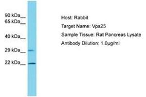 Image no. 1 for anti-Vacuolar Protein-Sorting-Associated Protein 25 (VPS25) (C-Term) antibody (ABIN6750447) (VPS25 Antikörper  (C-Term))