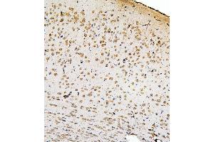 IHC analysis of SMAD2 using anti-SMAD2 antibody (ABIN6719361). (SMAD2 Antikörper  (AA 83-264))