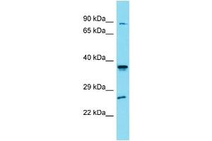 Western Blotting (WB) image for anti-Solute Carrier Family 35, Member G4 (SLC35G4) (N-Term) antibody (ABIN2791457) (SLC35G4 Antikörper  (N-Term))