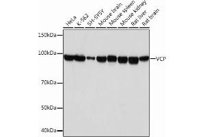 Western blot analysis of extracts of various cell lines, using VCP Rabbit mAb (ABIN7271284) at 1:1000 dilution. (VCP Antikörper)