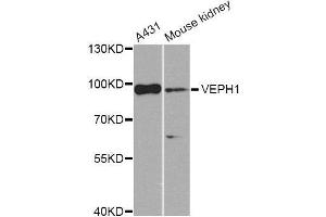 Western blot analysis of extracts of various cell lines, using VEPH1 Antibody. (VEPH1 Antikörper  (AA 448-547))