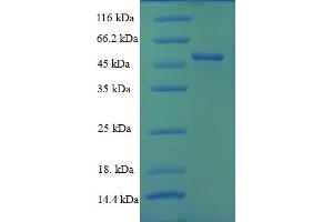VP6 (AA 1-397), (full length) protein (His tag)