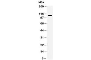 Western blot testing of human 293 cell lysate with EPHB1 antibody.