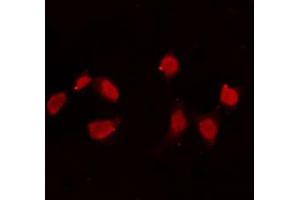 ABIN6274165 staining Hela cells by IF/ICC. (Topoisomerase II alpha Antikörper  (Internal Region))