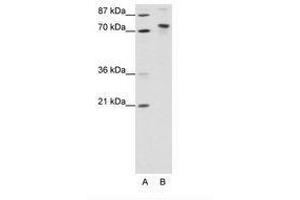 Image no. 1 for anti-TOX High Mobility Group Box Family Member 4 (TOX4) (N-Term) antibody (ABIN307424) (TOX4 Antikörper  (N-Term))
