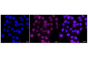 Immunocytochemical staining of HT- cells with NR2E1 antibody (ABIN7799654), 1:1,000).