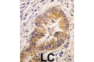 Immunohistochemistry (IHC) image for anti-Cell Division Cycle Associated 8 (CDCA8) antibody (ABIN2998016) (CDCA8 Antikörper)