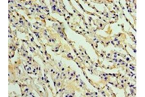 Immunohistochemistry of paraffin-embedded human lung tissue using ABIN7142914 at dilution of 1:100 (AKAP8L Antikörper  (AA 1-240))