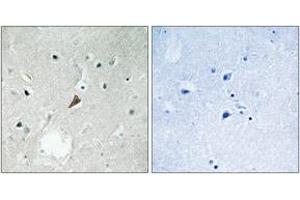 Immunohistochemistry analysis of paraffin-embedded human brain, using PYK2 (Phospho-Tyr579) Antibody. (PTK2B Antikörper  (pTyr579))