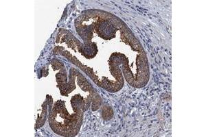 Immunohistochemical staining of human prostate with KBTBD8 polyclonal antibody  shows strong cytoplasmic positivity in glandular cells. (KBTBD8 Antikörper)