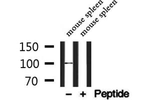 Western blot analysis of extracts from mouse spleen, using BCAM Antibody.