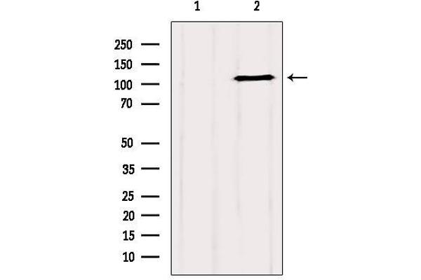 GRIP1 Antikörper  (Internal Region)