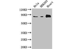 Western Blot Positive WB detected in: Hela whole cell lysate, HEK293 whole cell lysate, Mouse heart tissue All lanes: ABLIM1 antibody at 3. (ABLIM1 Antikörper  (AA 174-319))