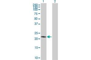 Western Blot analysis of AK1 expression in transfected 293T cell line by AK1 MaxPab polyclonal antibody. (Adenylate Kinase 1 Antikörper  (AA 1-194))
