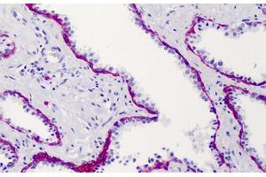 Human Prostate: Formalin-Fixed, Paraffin-Embedded (FFPE) (Syndecan 1 Antikörper)