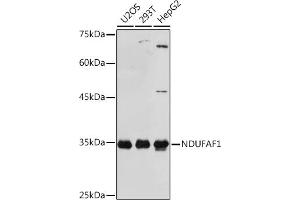 Western blot analysis of extracts of various cell lines, using NDUF Rabbit mAb (ABIN1681278, ABIN3018403, ABIN3018404 and ABIN7101607) at 1:1000 dilution. (NDUFAF1 Antikörper)