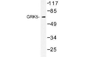 Image no. 1 for anti-G Protein-Coupled Receptor Kinase 5 (GRK5) antibody (ABIN272181) (GRK5 Antikörper)