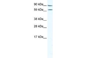 WB Suggested Anti-MTA2 Antibody Titration:  5. (MTA2 Antikörper  (Middle Region))