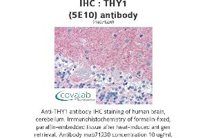 Image no. 3 for anti-CD90 (THY1) antibody (ABIN1724058) (CD90 Antikörper)