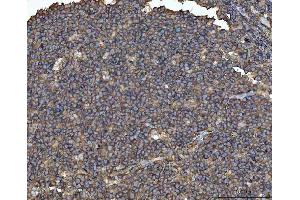 IHC analysis of MTHFD1 using anti-MTHFD1 antibody (ABIN7600631).