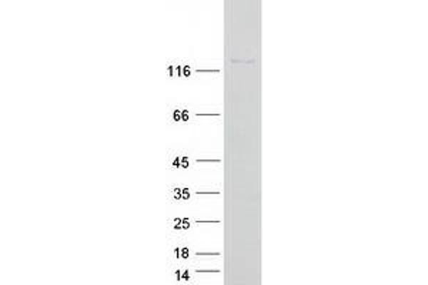 ADAMTS6 Protein (Myc-DYKDDDDK Tag)