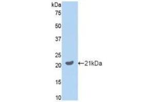 Western Blotting (WB) image for Growth Arrest-Specific 6 (GAS6) ELISA Kit (ABIN6730934)