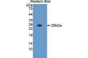 Detection of Recombinant IL35, Mouse using Polyclonal Antibody to Interleukin 35 (IL35) (Interleukin 35 Antikörper  (AA 23-215))